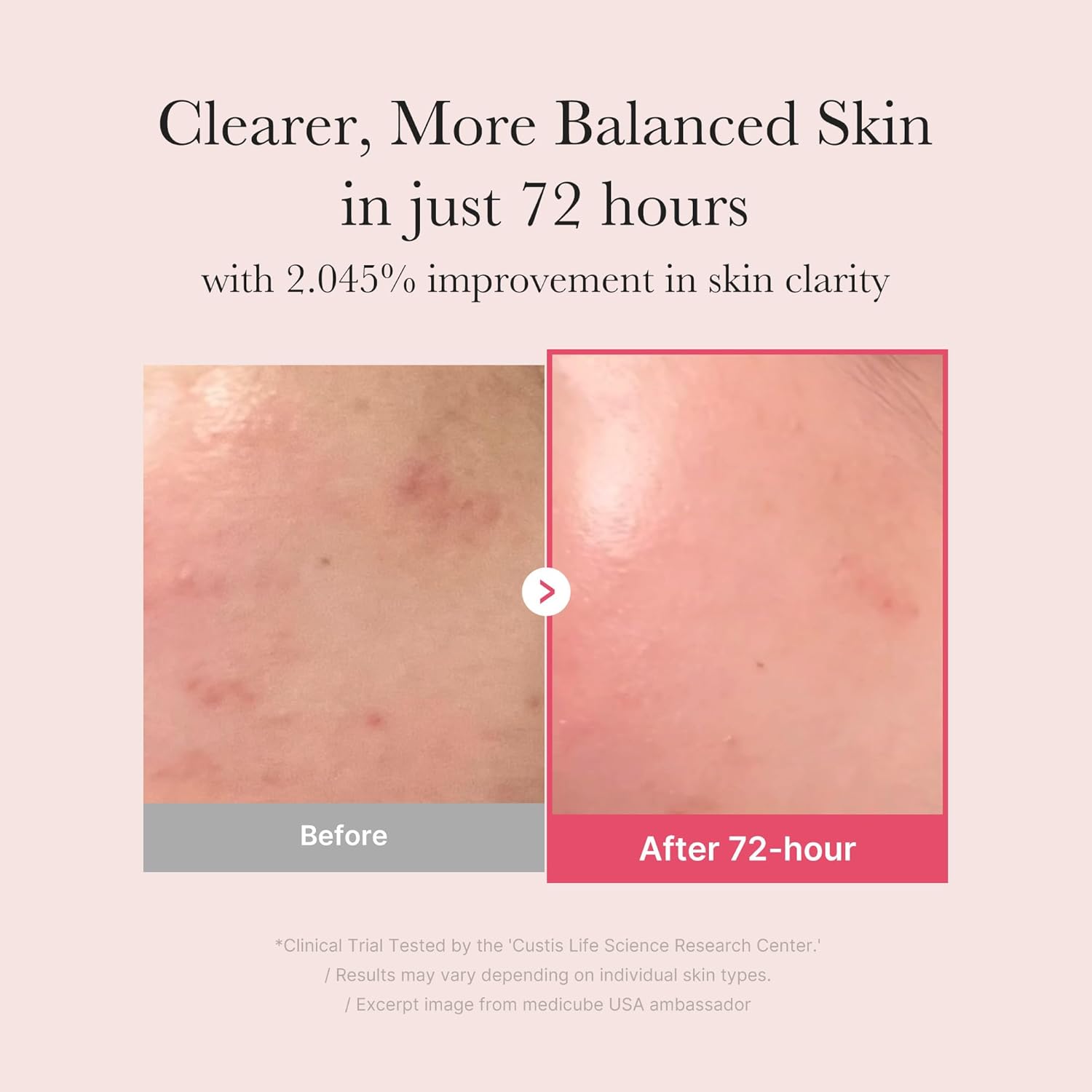 Medicube TXA + Niacinamide 15% Glow Facial Serum