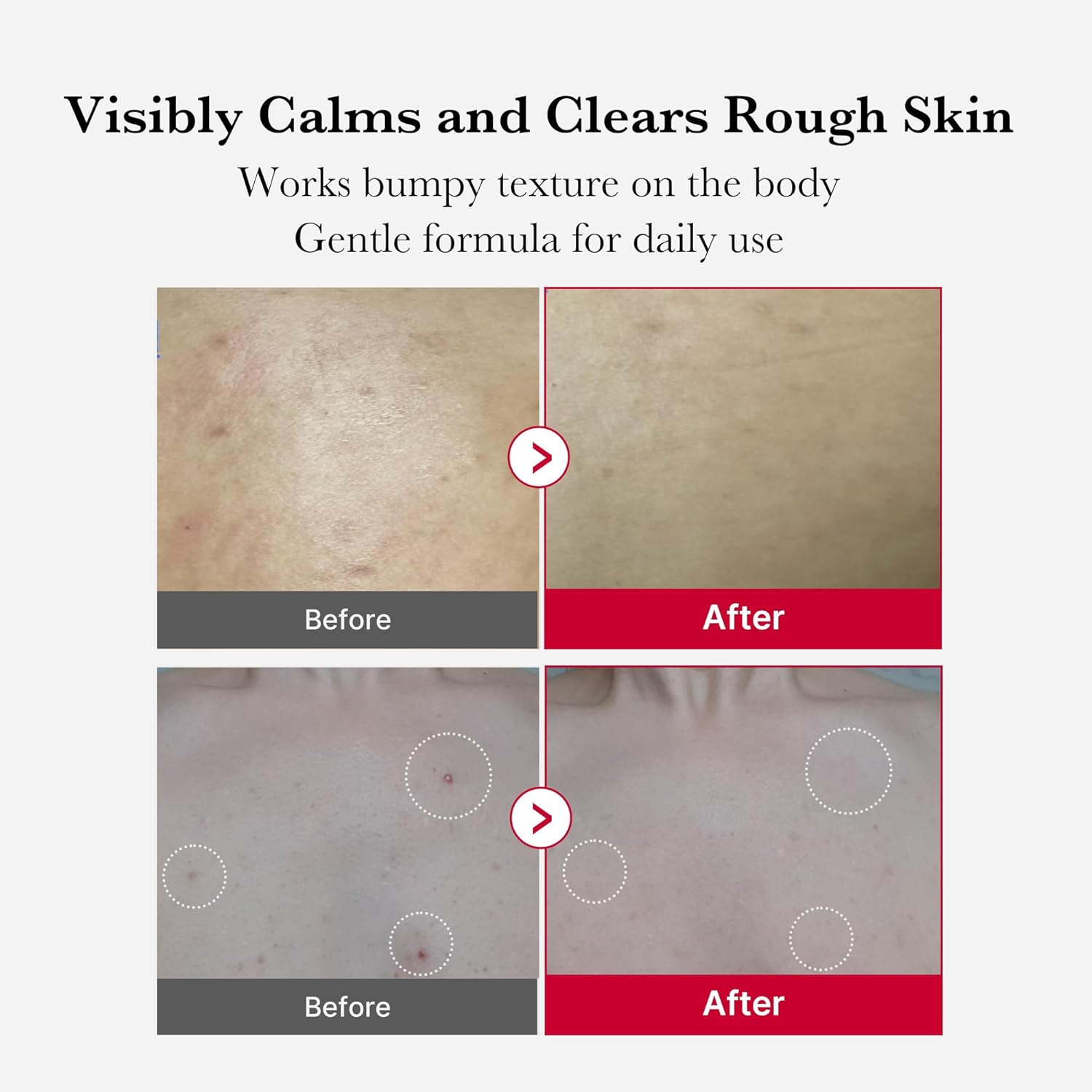 Medicube Red Body Peeling Shot Cleanser