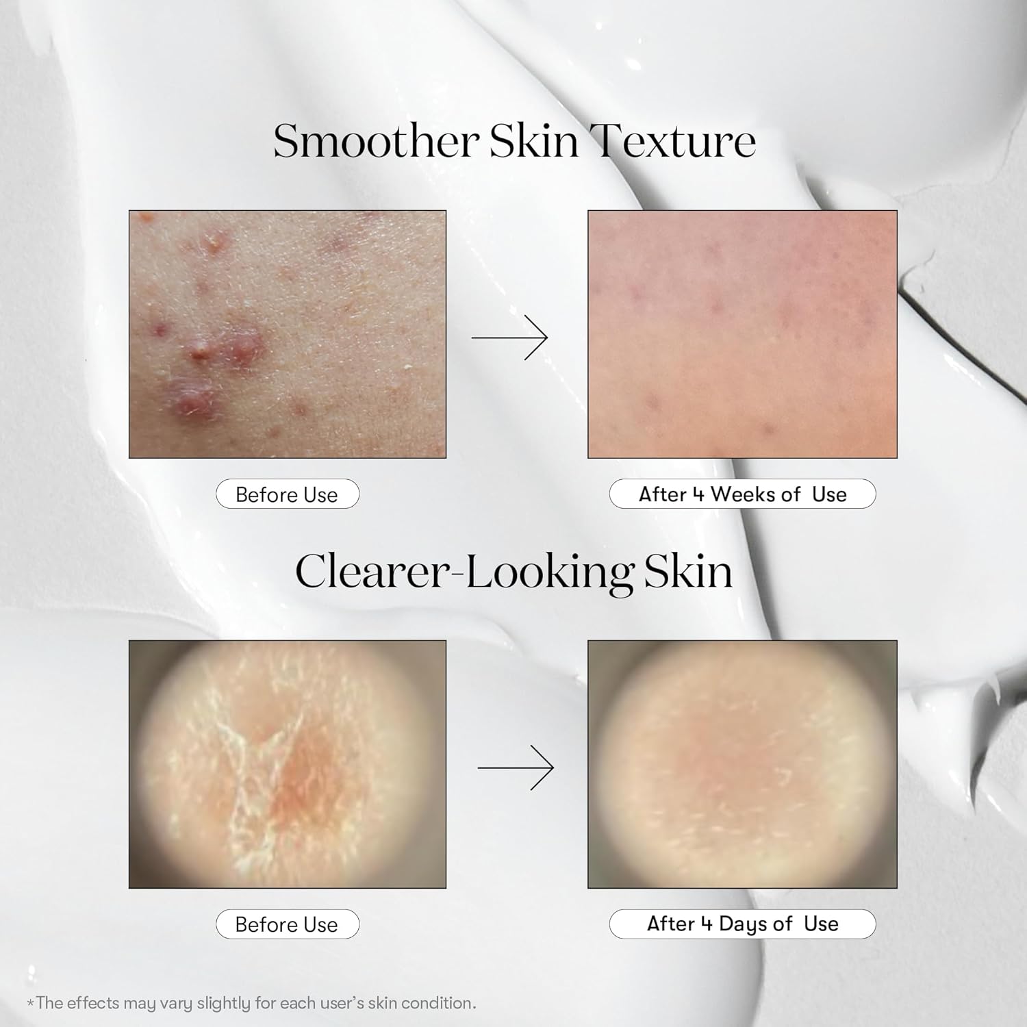 VT COSMETICS CICA REEDLE SHOT 700