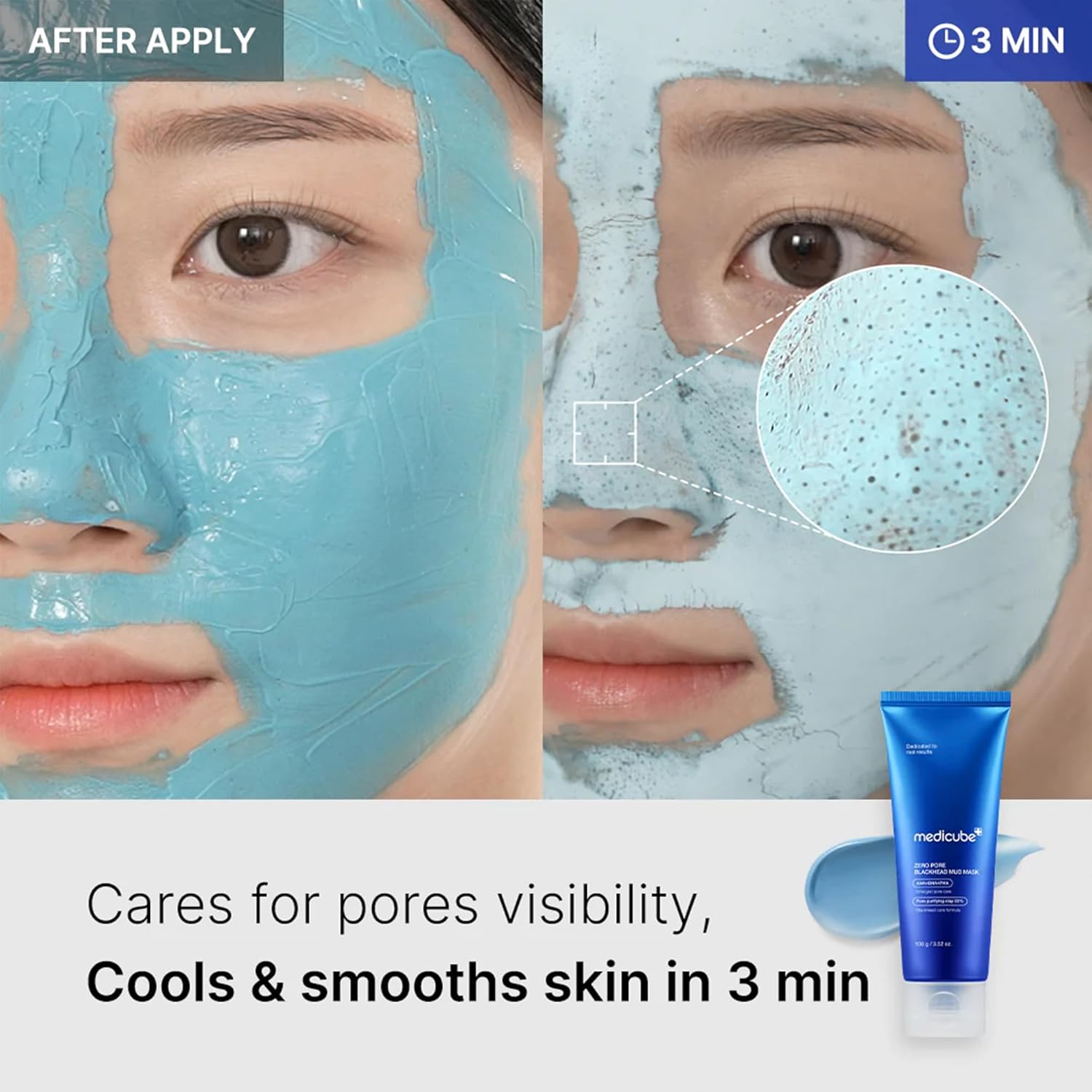 Medicube Zero Pore Blackhead Mud Facial Mask - 3.52 oz