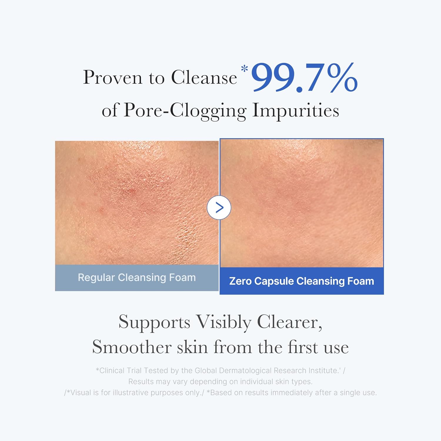 Medicube Zero Pore SA Clear Capsule Cleansing Foam – 120g