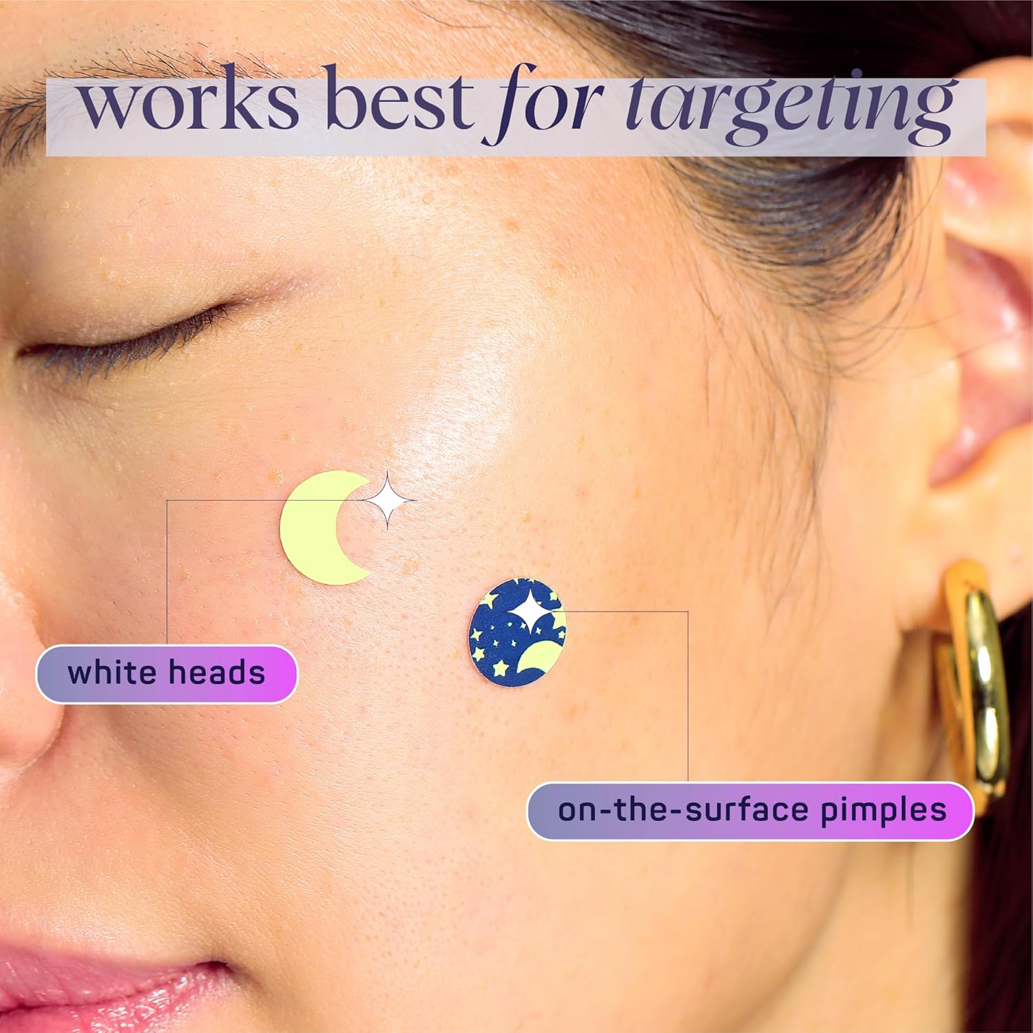 Glow in the Dark Pimple Patches - YesMegastore