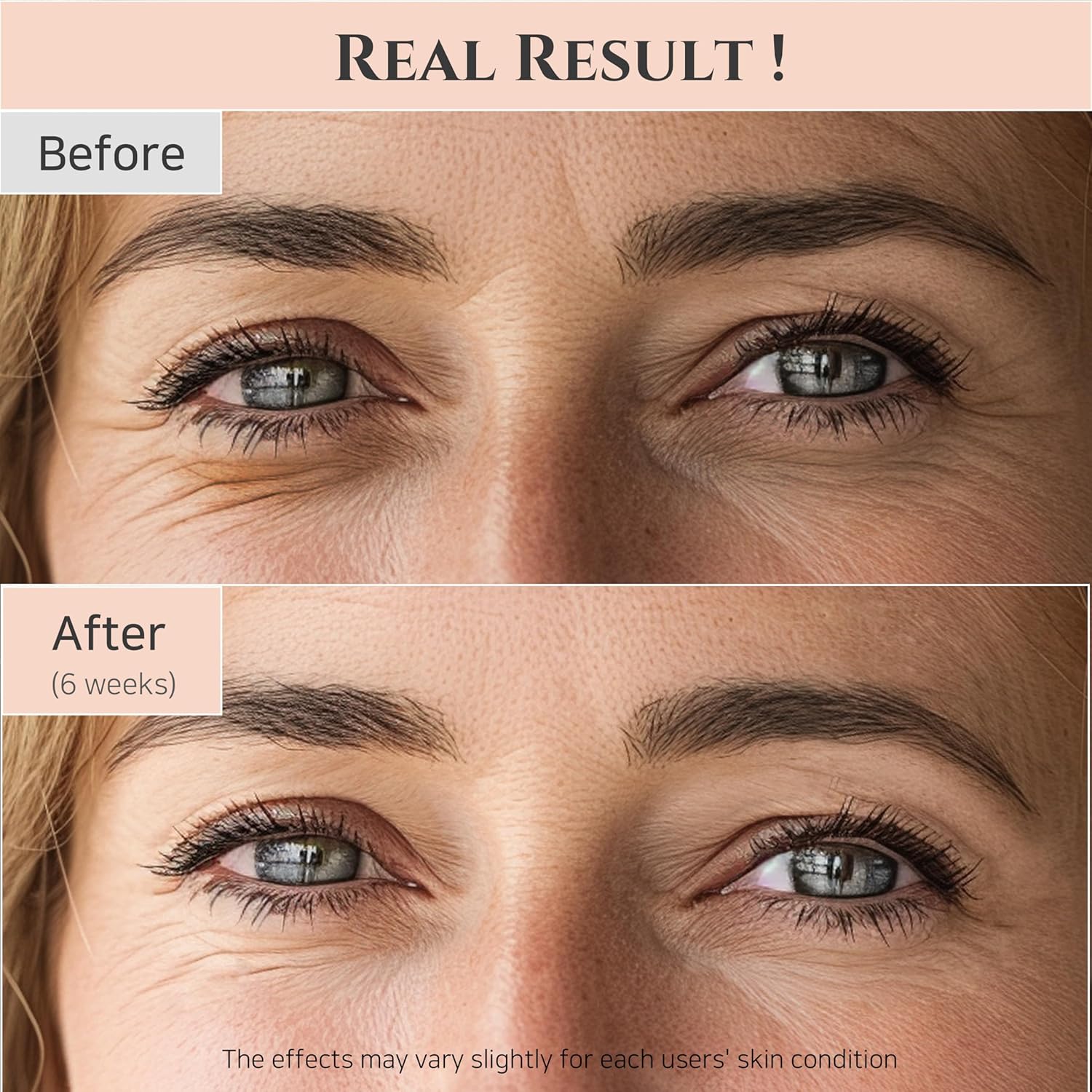 Beauty of Joseon Revive Eye Serum – Retinal + Niacinamide
