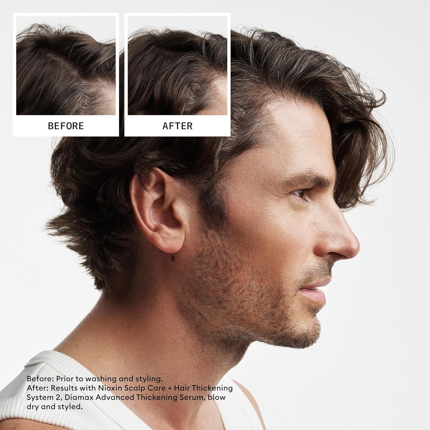 Nioxin 2 - Progressed Thinning-Conditioner